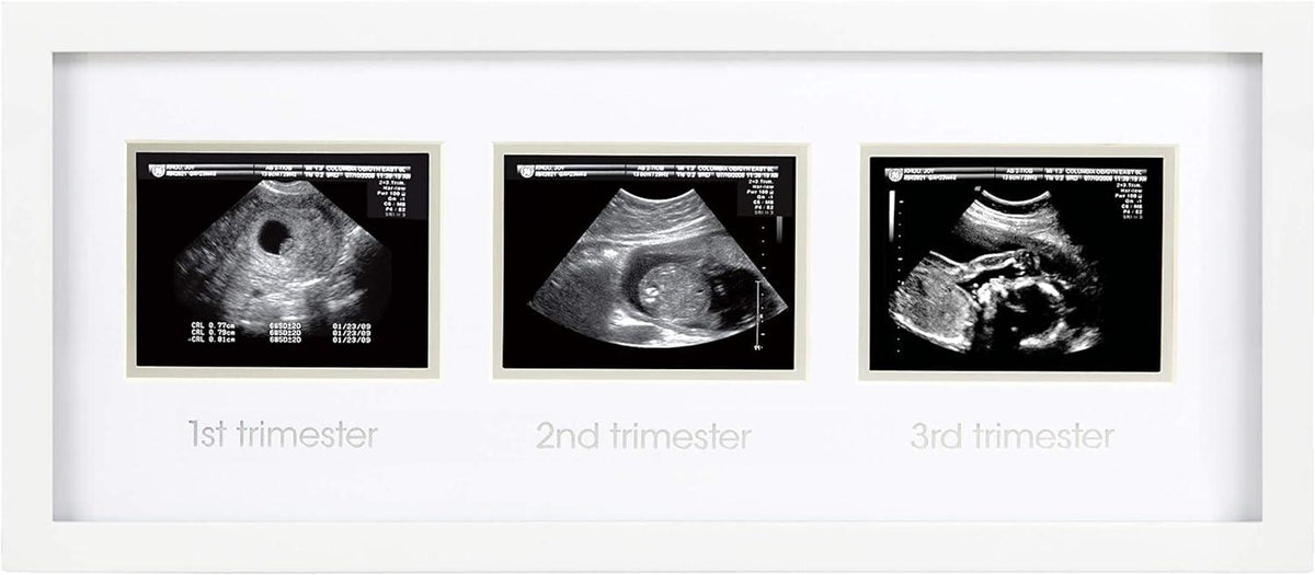 Pearhead Triple Sonogram Pregnancy Keepsake Frame White - Mari Kali Stores Cyprus